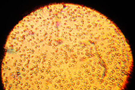 milk under microscope heterogeneous mixture